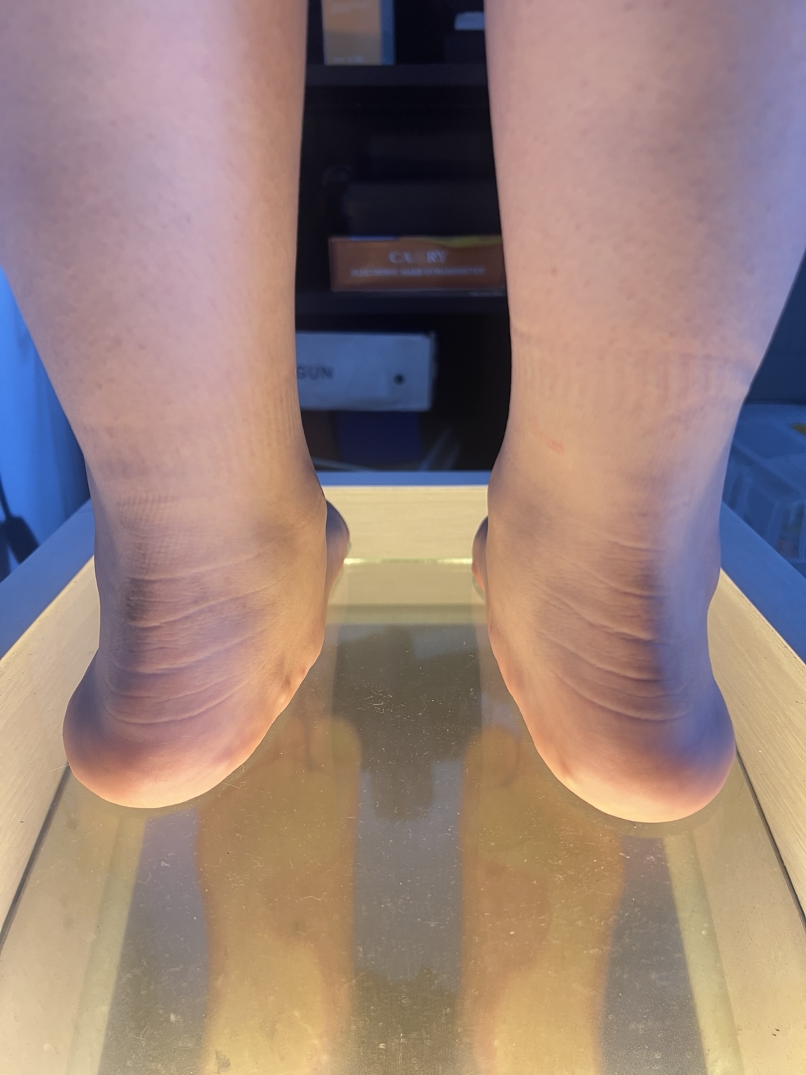 Sesión de recuperación en VidaKine